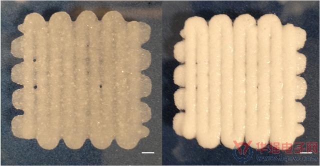骨折了？3D打印“面团”可以派上用场