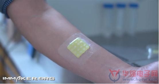 这个能发光的绷带可检测是否感染